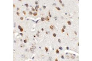 Immunohistochemistry of CHD7 in mouse brain tissue with CHD7 antibody at 5 ug/mL. (CHD7 抗体  (N-Term))