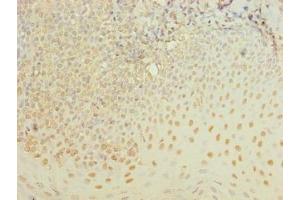Immunohistochemistry of paraffin-embedded human tonsil tissue using ABIN7175990 at dilution of 1:100 (ZBTB6 抗体  (AA 115-424))