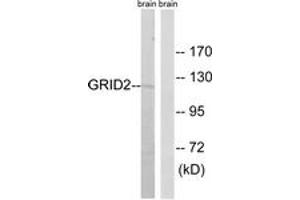 Western blot analysis of extracts from mouse brain cells, using GRID2 Antibody. (GRID2 抗体  (AA 831-880))