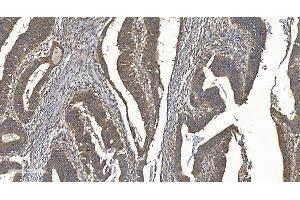 IHC analysis of YTHDF2 using anti-YTHDF2 antibody (ABIN7603191). (YTHDF2 抗体  (N-Term))