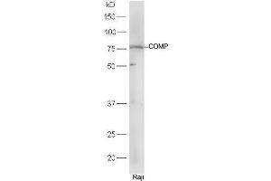 Raji cell lysates probed with Rabbit Anti-COMP Polyclonal Antibody, Unconjugated (ABIN2559644) at 1:300 in 4˚C. (COMP 抗体  (AA 221-320))