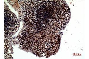 Immunohistochemistry (IHC) analysis of paraffin-embedded Human Tonsilla, antibody was diluted at 1:100.