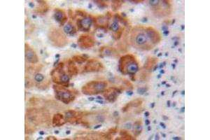 #VALUE! (Apolipoprotein M 抗体  (AA 20-190))