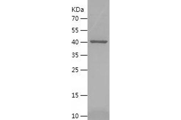 SERPINB8 Protein (AA 1-374) (His tag)