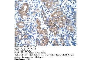 Immunohistochemistry (IHC) image for anti-Prostaglandin-Endoperoxide Synthase 1 (Prostaglandin G/H Synthase and Cyclooxygenase) (PTGS1) (N-Term) antibody (ABIN2777018)