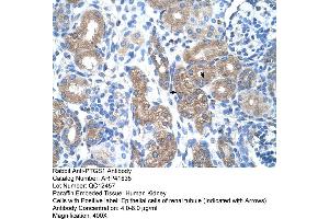 Rabbit Anti-PTGS1 Antibody  Paraffin Embedded Tissue: Human Kidney Cellular Data: Epithelial cells of renal tubule Antibody Concentration: 4. (PTGS1 抗体  (N-Term))