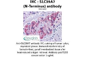 Image no. 2 for anti-Solute Carrier Family 39 (Zinc Transporter), Member 7 (SLC39A7) (N-Term) antibody (ABIN1739379)