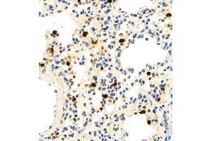 Immunohistochemistry (Paraffin-embedded Sections) (IHC (p)) image for anti-S100 Calcium Binding Protein A9 (S100A9) antibody (ABIN7075497)