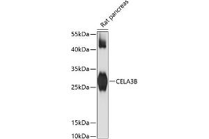Western blot analysis of extracts of rat pancreas, using CELB antibody (ABIN6133505, ABIN6138397, ABIN6138398 and ABIN6217810) at 1:3000 dilution. (Elastase 3B 抗体  (AA 80-190))