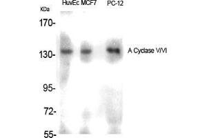 Western Blot (WB) analysis of specific cells using A Cyclase V/VI Polyclonal Antibody. (ADCY5/6 抗体  (C-Term))