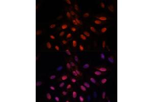 Immunofluorescence analysis of U-2 OS cells using TPI1 antibody (ABIN7270977) at dilution of 1:100. (TPI1 抗体  (AA 1-249))