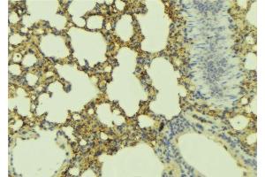 ABIN6277452 at 1/100 staining Mouse lung tissue by IHC-P. (ADCYAP1R1 抗体  (C-Term))