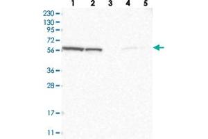 Western blot analysis of Lane 1: RT-4, Lane 2: U-251 MG, Lane 3: Human Plasma, Lane 4: Liver, Lane 5: Tonsil with GOPC polyclonal antibody  at 1:250-1:500 dilution.