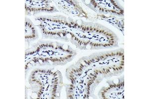 Immunohistochemistry of paraffin-embedded mouse stomach using FOSB Rabbit pAb (ABIN7267159) at dilution of 1:150 (40x lens).