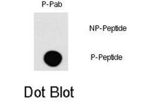 Dot blot analysis of MAP3K1 (phospho T1383) polyclonal antibody  on nitrocellulose membrane. (MAP3K1 抗体  (pThr1400))