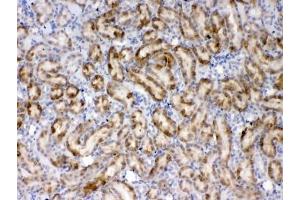 IHC testing of FFPE rat kidney tissue with Thrombopoietin antibody at 1ug/ml. (Thrombopoietin 抗体)