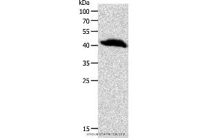 Western blot analysis of Human liver cancer tissue, using OPRL1 Polyclonal Antibody at dilution of 1:900 (OPRL1 抗体)