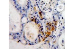 Used in DAB staining on fromalin fixed paraffin-embedded Pancreas tissue (MNDA 抗体  (AA 189-405))