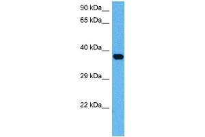 Host:  Mouse  Target Name:  ATF4  Sample Tissue:  Mouse Brain  Antibody Dilution:  1ug/ml (ATF4 抗体)