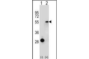 Western blot analysis of ESRRA (arrow) using rabbit polyclonal ESRRA Antibody (Center) (ABIN652575 and ABIN2842387). (ESRRA 抗体  (AA 131-159))