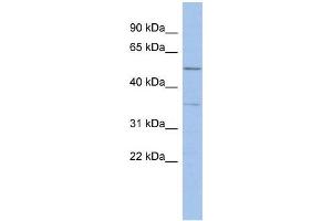 Human ACHN; WB Suggested Anti-ABHD15 Antibody Titration: 0. (ABHD15 抗体  (Middle Region))