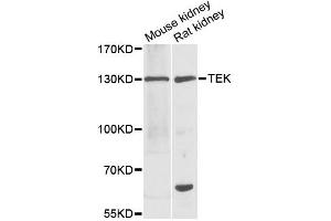 Western blot analysis of extracts of various cell lines, using TEK antibody. (TEK 抗体)