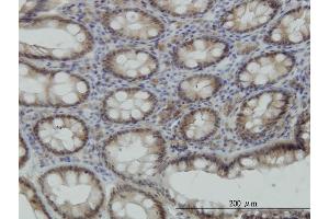 Immunoperoxidase of monoclonal antibody to STK38 on formalin-fixed paraffin-embedded human colon. (STK38 抗体  (AA 365-465))