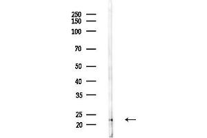 anti-Calcium Binding Protein P22 (CHP) (Internal Region) antibody