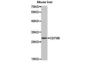 Western Blotting (WB) image for anti-CD79b Molecule, Immunoglobulin-Associated beta (CD79B) antibody (ABIN1871654) (CD79b 抗体)