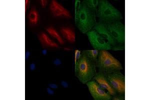 ABIN6262303 and ABIN6276781 staining  cells by IF/ICC. (HMGCR 抗体  (N-Term))