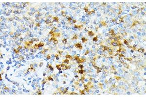 Immunohistochemistry of paraffin-embedded Human tonsil using SPTA1 Polyclonal Antibody at dilution of 1:100 (40x lens). (SPTA1 抗体)