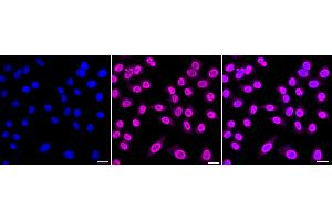 Immunocytochemical staining of HepG2 cells with Phospho-Nucleophosmin (T199) antibody (ABIN7799673), 1:1,000).