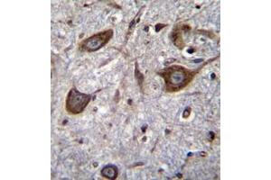 Immunohistochemistry (Paraffin-embedded Sections) (IHC (p)) image for anti-Glutamate Receptor, Ionotropic, AMPA 4 (GRIA4) (AA 295-325), (Middle Region) antibody (ABIN952535)