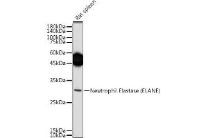 Western blot analysis of extracts of Rat spleen, using Neutrophil Elastase (ELANE) antibody (ABIN6131604, ABIN6140110, ABIN6140111 and ABIN6216843) at 1:500 dilution. (ELANE 抗体  (AA 30-267))