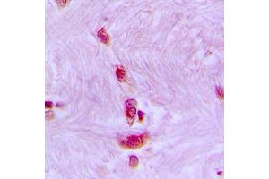 Immunohistochemical analysis of CDC40 staining in human brain formalin fixed paraffin embedded tissue section. (CDC40 抗体  (Center))