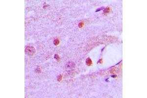 Immunohistochemical analysis of MSH6 staining in human brain formalin fixed paraffin embedded tissue section. (MSH6 抗体  (Center))