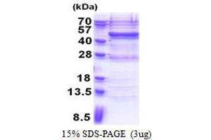 Vav 1 Oncogene (VAV1) (AA 189-565) protein (His tag)