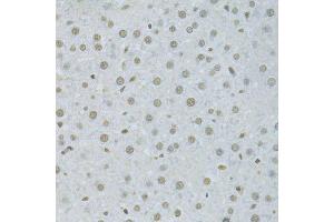 Immunohistochemistry of paraffin-embedded rat liver using HNRNPK Antibody.