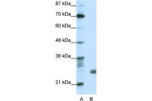 Western Blotting (WB) image for anti-Sin3A-Associated Protein, 30kDa (SAP30) antibody (ABIN2461707) (SAP30 抗体)