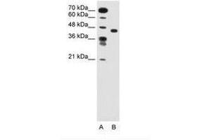 Image no. 1 for anti-Solute Carrier Family 35, Member C1 (SLC35C1) (AA 51-100) antibody (ABIN205019) (SLC35C1 抗体  (AA 51-100))