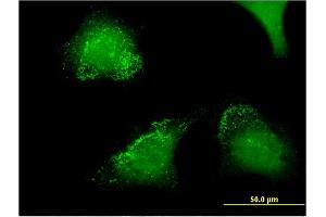 Immunofluorescence of monoclonal antibody to ACP5 on HeLa cell. (ACP5 抗体  (AA 72-158))