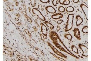 ABIN6269218 at 1/100 staining Human kidney tissue by IHC-P.