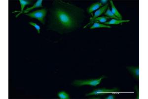 Immunofluorescence of purified MaxPab antibody to MAPKAPK2 on HeLa cell.