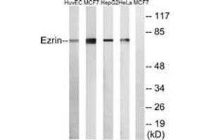 Western blot analysis of extracts from HuvEc/MCF-7/HepG2/HeLa cells, using Ezrin Antibody. (Ezrin 抗体  (AA 511-560))