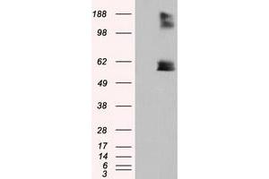 HEK293T cells were transfected with the pCMV6-ENTRY control (Left lane) or pCMV6-ENTRY LIPG (Right lane) cDNA for 48 hrs and lysed. (LIPG 抗体)