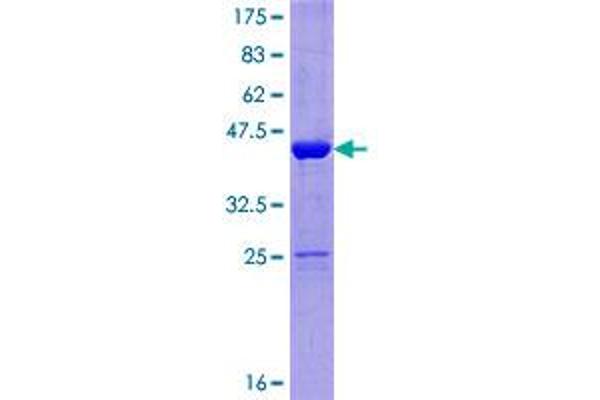 NUDCD2 Protein (AA 1-157) (GST tag)