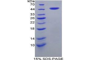 SDS-PAGE analysis of Human CRH Protein. (CRH 蛋白)