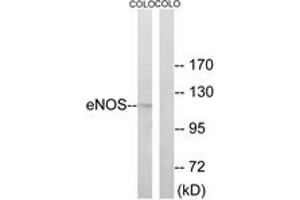 Western Blotting (WB) image for anti-Nitric Oxide Synthase 3 (Endothelial Cell) (NOS3) (AA 462-511) antibody (ABIN2888982) (ENOS 抗体  (AA 462-511))