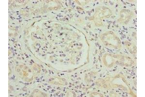 Immunohistochemistry of paraffin-embedded human kidney tissue using ABIN7169799 at dilution of 1:100 (SLITRK4 抗体  (AA 201-500))