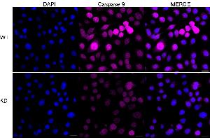 Immunocytochemical staining of HeLa cells using Caspase 9 antibody (ABIN7797912), 1:1,000), Top panel: wild-type (WT), Bottom panal: Caspase 9 shRNA knockdown (KD).